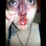 Crazy As Fuck SickJunk Fan, Brakes Her Nose Then Sew It Up With A Needle