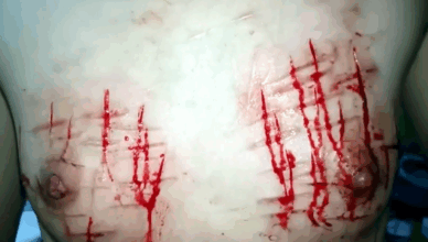 Crazy Sickjunk Fan Cutting Her Tits Into Pieces